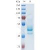 sp-pme101630 cdh1 sp1