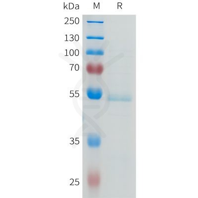 sp-pme101636 ror2 sp1