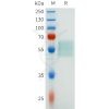 sp-pme101638 csf1r sp1