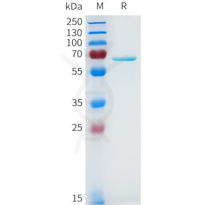 sp-pme101645 akt1 sp1
