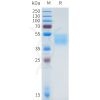 sp-pme101656 fgfr2iiib sp1