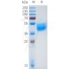 sp-pme101657 fgfr2iiib sp1