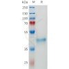 sp-pme101664 epha3 sp1