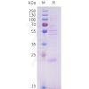 sp-pme101704 il11 sp1