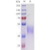 sp-pme101708 acvr2a sp1