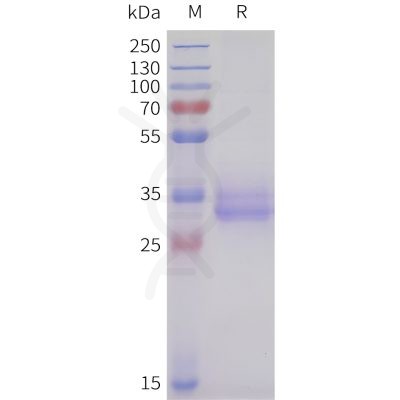 sp-pme101710 acvr2b sp1