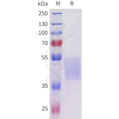 sp-pme101711 acvr2b sp1