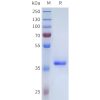sp-pme101715 tgfb3 sp1