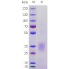 sp-pme101716 acvr2a sp1