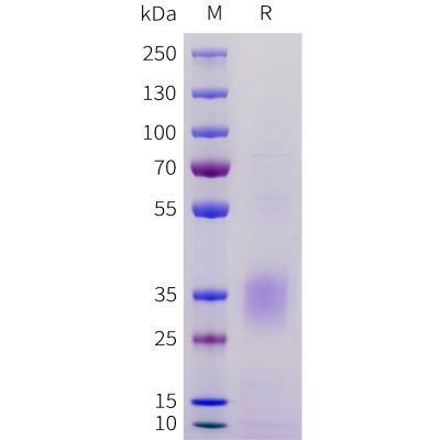 sp-pme101716 acvr2a sp1