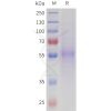 sp-pme101718 nptx2 sp1