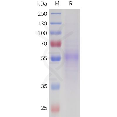 sp-pme101718 nptx2 sp1