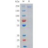 sp-pme101719 lrp6 sp1