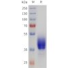 sp-pme101721 drd2 sp1
