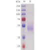sp-pme101726 sez6 sp1