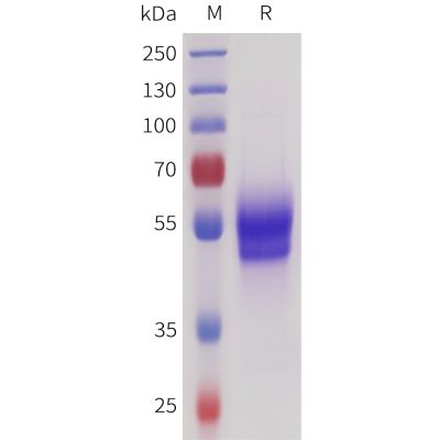 sp-pme101727 sez6 sp1