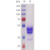 sp-pme101728 sez6 sp1