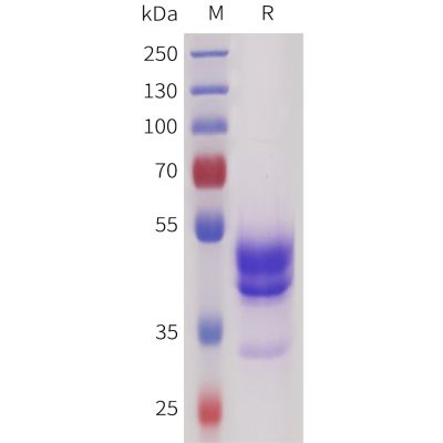 sp-pme101728 sez6 sp1