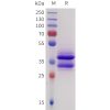 sp-pme101730 sez6 sp1