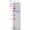 sp-pme101732 ighe sp1