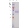 sp-pme101734 ighe sp1