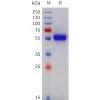sp-pme101740 tnfrsf11b sp1