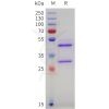 sp-pme101746 vegfc sp1