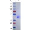 sp-pme101751 anxa2 sp1