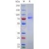 sp-pme101752 epha10 sp1