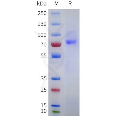sp-pme101752 epha10 sp1