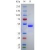 sp-pme101755 nppa sp1