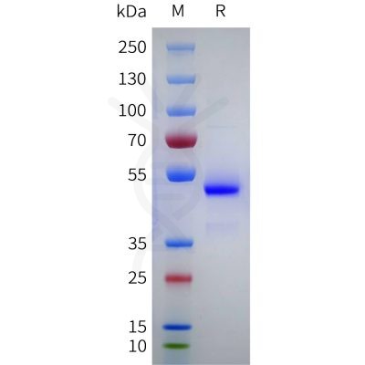sp-pme101755 nppa sp1