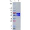 sp-pme101779 adrb1 sp1
