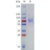 sp-pme101786 lilrb1 sp1