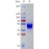 sp-pme101787 kiss1r sp1