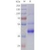 sp-pme101793 tgfb2 sp1