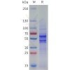 sp-pme101794 vegfb sp1