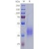 sp-pme101803 lilra5 sp1