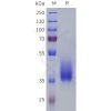 sp-pme101808 ptgfr sp1