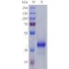 sp-pme101809 s1pr5 sp1