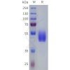 sp-pme101815 vipr2 sp1
