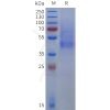 sp-pme101816 dcn sp1