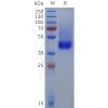 sp-pme101817 dcn sp1