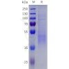 sp-pme101820 igfbp3 sp1