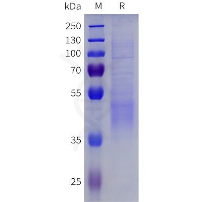 sp-pme101820 igfbp3 sp1