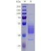 sp-pme101822 npy1r sp1