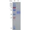 sp-pme101827 ackr2 sp1