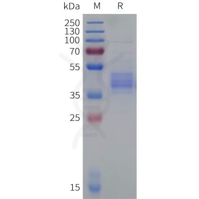 sp-pme101827 ackr2 sp1