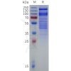 sp-pme101829 itga4 sp1