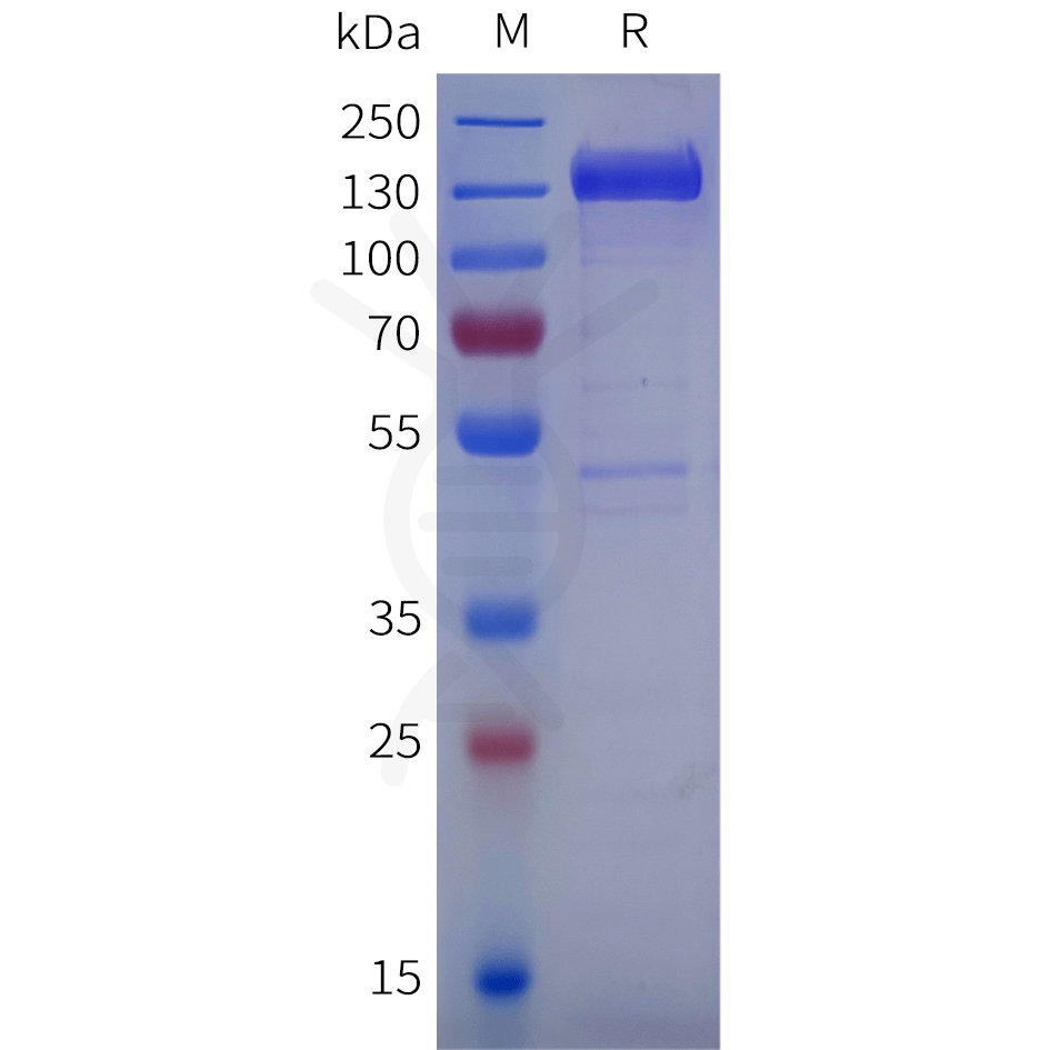 sp-pme101841 cdh17 sp1